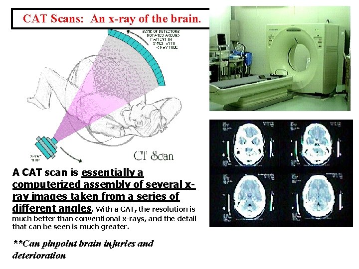 CAT Scans: An x-ray of the brain. A CAT scan is essentially a computerized