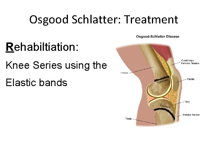 Osgood Schlatter: Treatment Rehabiltiation: Knee Series using the Elastic bands 