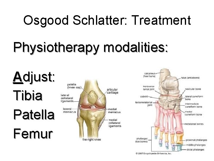 Osgood Schlatter: Treatment Physiotherapy modalities: Adjust: Tibia Patella Femur 