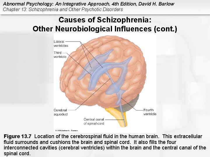 Abnormal Psychology: An Integrative Approach, 4 th Edition, David H. Barlow Chapter 13: Schizophrenia