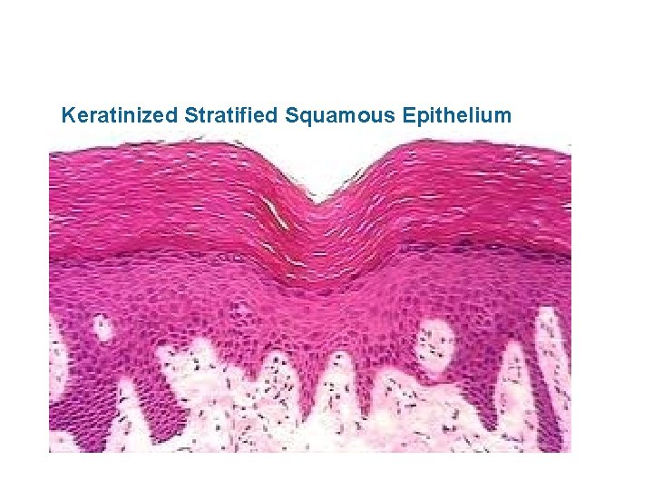 Keratinized Stratified Squamous Epithelium 