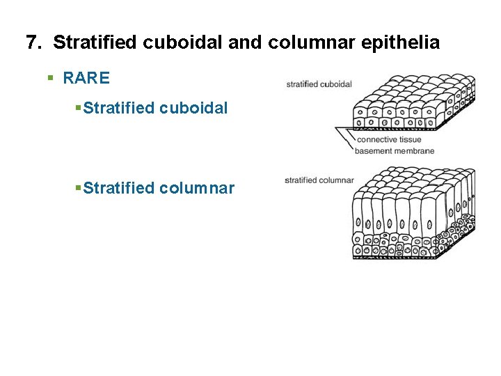 7. Stratified cuboidal and columnar epithelia § RARE §Stratified cuboidal §Stratified columnar 