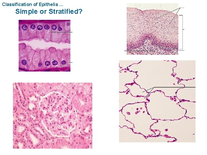 Classification of Epithelia … Simple or Stratified? 