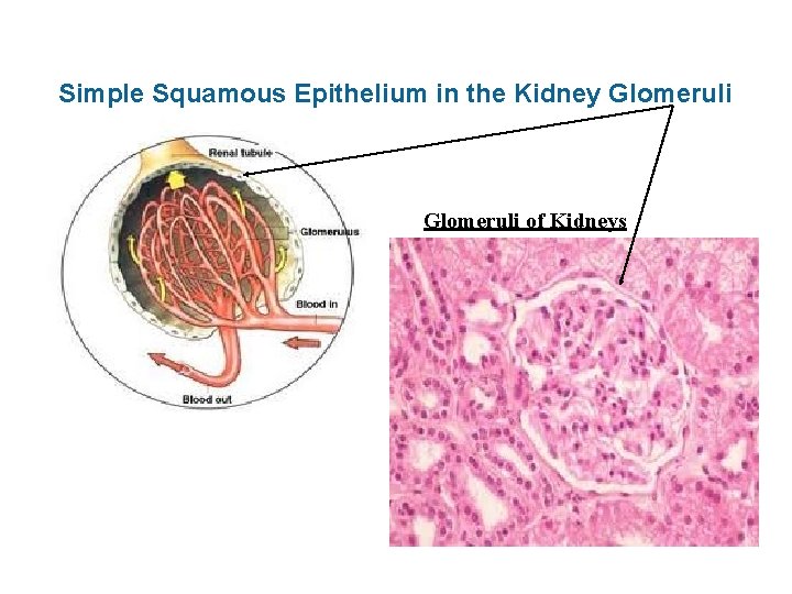 Simple Squamous Epithelium in the Kidney Glomeruli of Kidneys 