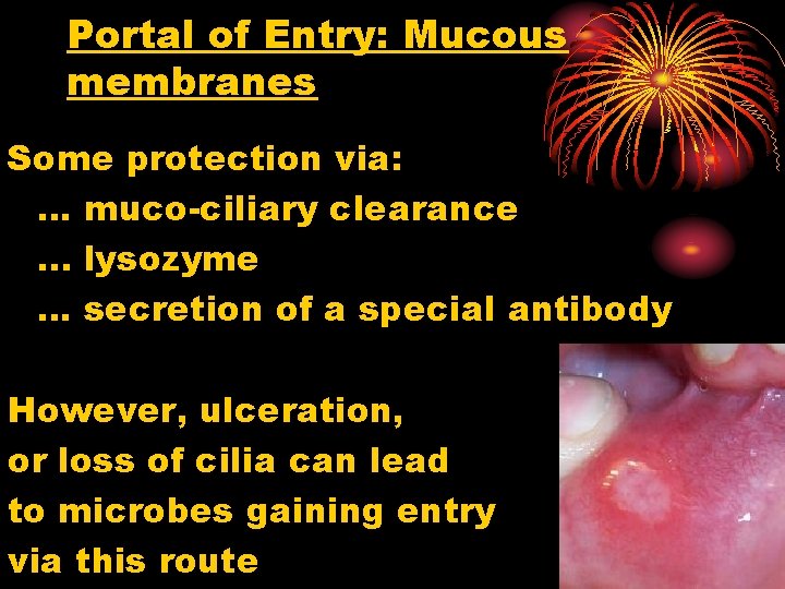 Portal of Entry: Mucous membranes Some protection via: … muco-ciliary clearance. . . lysozyme