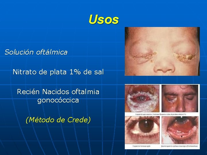 Usos Solución oftálmica Nitrato de plata 1% de sal Recién Nacidos oftalmia gonocóccica (Método