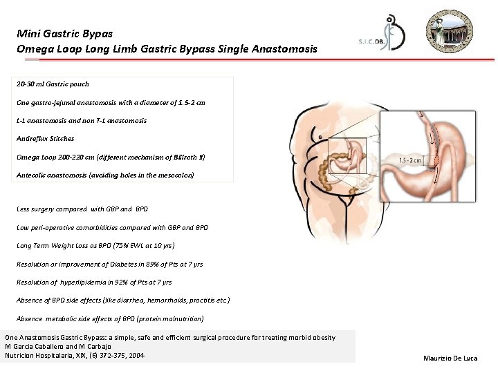 Mini Gastric Bypas Omega Loop Long Limb Gastric Bypass Single Anastomosis 20 -30 ml