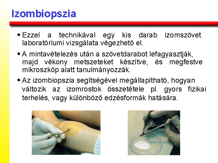 Izombiopszia w Ezzel a technikával egy kis darab izomszövet laboratóriumi vizsgálata végezhető el. w