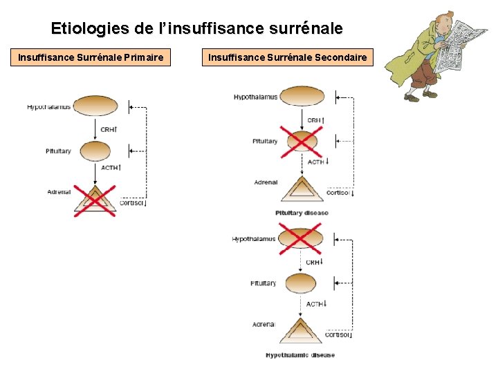 Etiologies de l’insuffisance surrénale Insuffisance Surrénale Primaire Insuffisance Surrénale Secondaire 