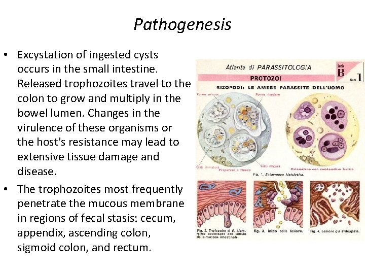 Pathogenesis • Excystation of ingested cysts occurs in the small intestine. Released trophozoites travel