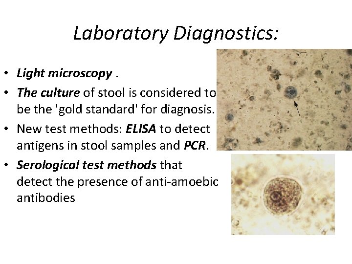 Laboratory Diagnostics: • Light microscopy. • The culture of stool is considered to be