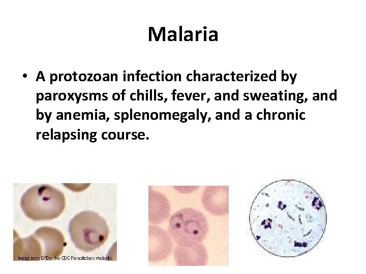 Malaria • A protozoan infection characterized by paroxysms of chills, fever, and sweating, and