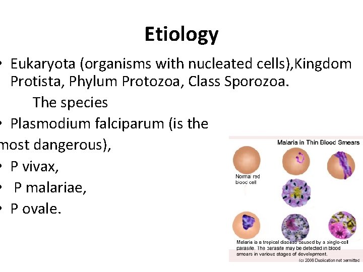 Etiology • Eukaryota (organisms with nucleated cells), Kingdom Protista, Phylum Protozoa, Class Sporozoa. The