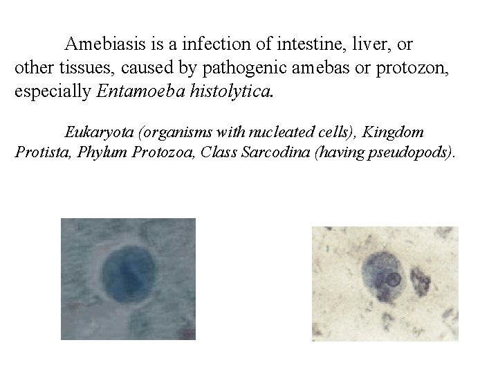 Amebiasis is a infection of intestine, liver, or other tissues, caused by pathogenic amebas