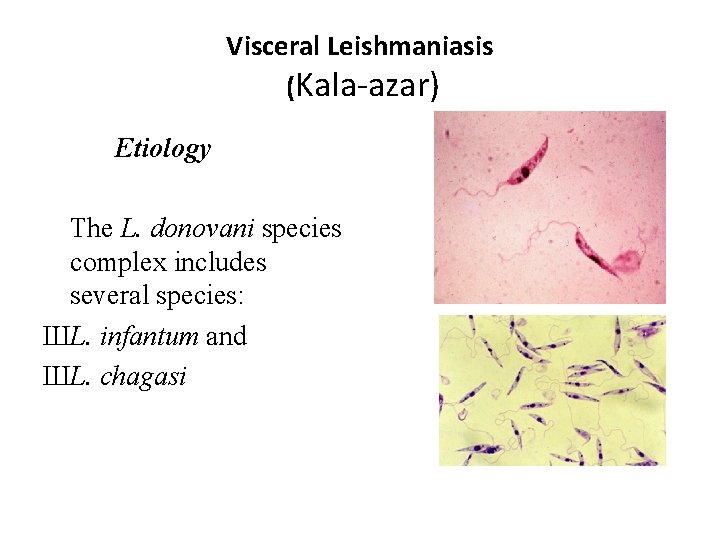 Visceral Leishmaniasis (Kala-azar) Etiology The L. donovani species complex includes several species: ШL. infantum