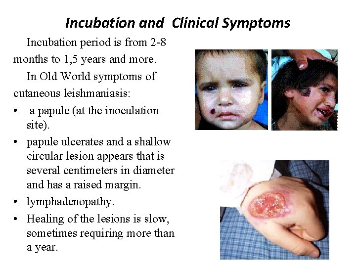 Incubation and Clinical Symptoms Incubation period is from 2 -8 months to 1, 5