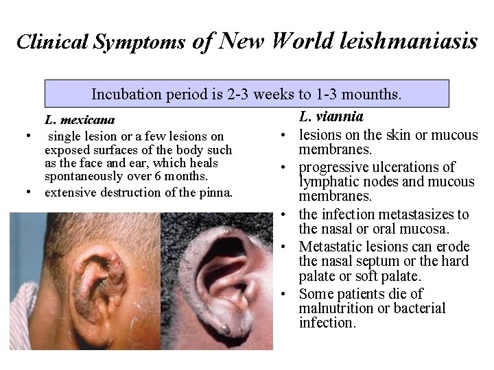 Clinical Symptoms of New World leishmaniasis Incubation period is 2 -3 weeks to 1