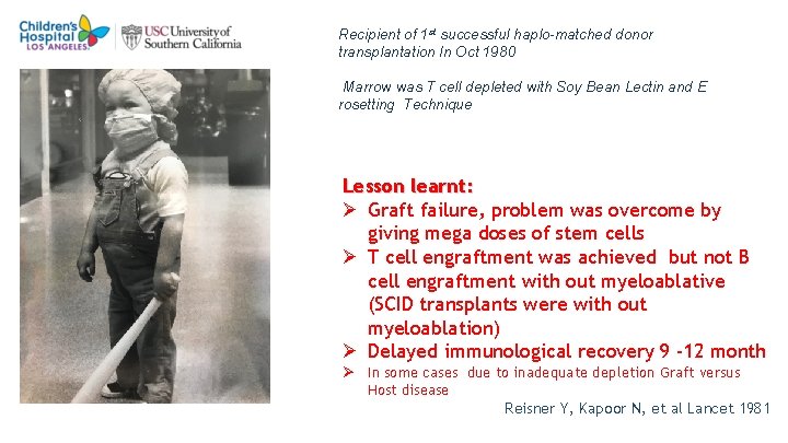 2 0 Recipient of 1 st successful haplo-matched donor transplantation In Oct 1980 Marrow