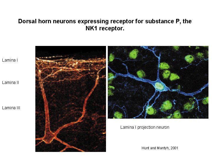 Dorsal horn neurons expressing receptor for substance P, the NK 1 receptor. Lamina III