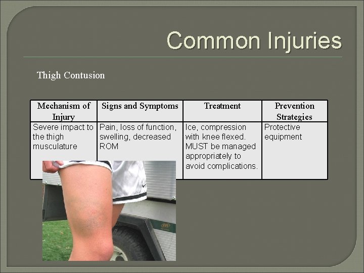 Common Injuries Thigh Contusion Mechanism of Injury Signs and Symptoms Severe impact to Pain,