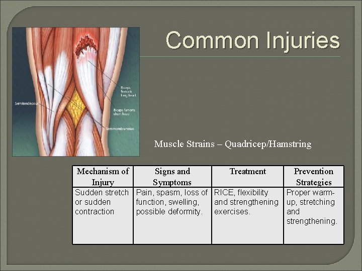 Common Injuries Muscle Strains – Quadricep/Hamstring Mechanism of Injury Signs and Symptoms Treatment Prevention