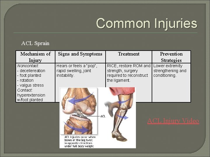 Common Injuries ACL Sprain Mechanism of Injury Noncontact: - decellereation - foot planted -