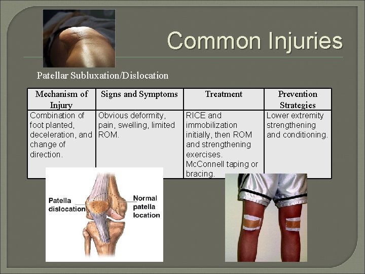 Common Injuries Patellar Subluxation/Dislocation Mechanism of Injury Signs and Symptoms Combination of Obvious deformity,