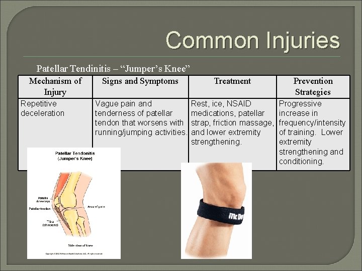 Common Injuries Patellar Tendinitis – “Jumper’s Knee” Mechanism of Injury Repetitive deceleration Signs and