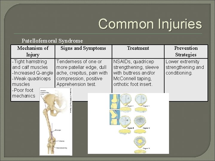 Common Injuries Patellofemoral Syndrome Mechanism of Injury Signs and Symptoms -Tight hamstring and calf