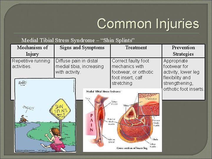 Common Injuries Medial Tibial Stress Syndrome – “Shin Splints” Mechanism of Injury Repetitive running