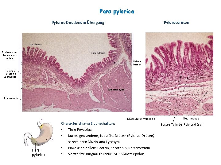 Pars pylorica Pylorus-Duodenum Übergang Pylorusdrüsen T. Mucosa mit Dünndarmzotten Pylorus. Drüsen Brunner. Drüsen in