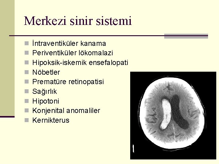 Merkezi sinir sistemi n n n n n İntraventiküler kanama Periventiküler lökomalazi Hipoksik-iskemik ensefalopati