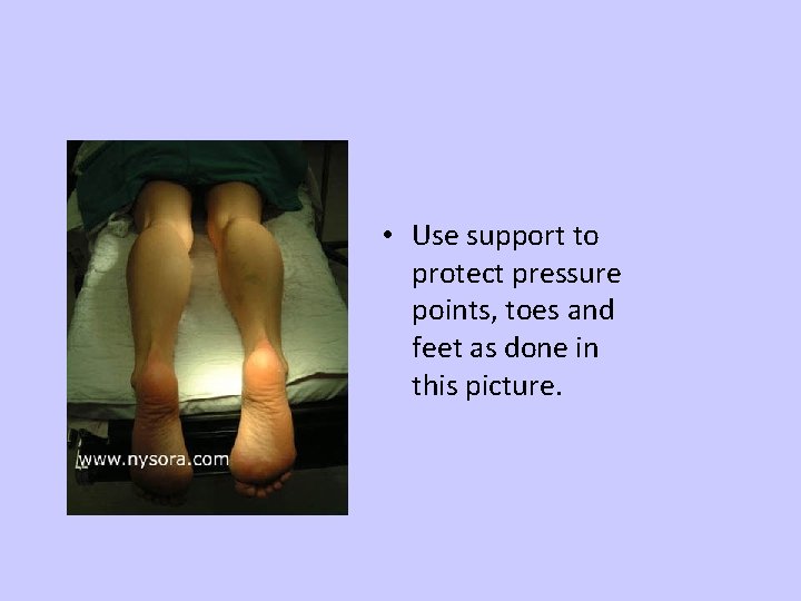  • Use support to protect pressure points, toes and feet as done in