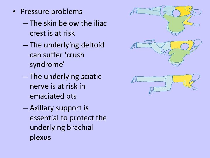  • Pressure problems – The skin below the iliac crest is at risk