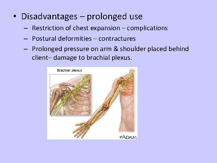  • Disadvantages – prolonged use – Restriction of chest expansion – complications –