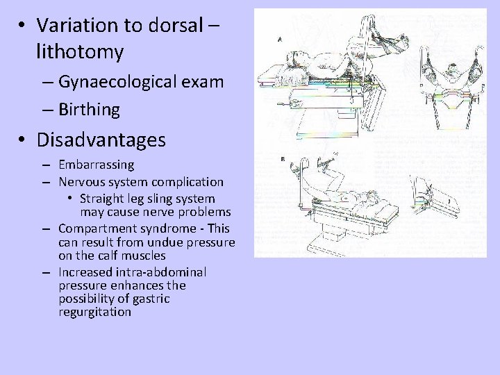  • Variation to dorsal – lithotomy – Gynaecological exam – Birthing • Disadvantages
