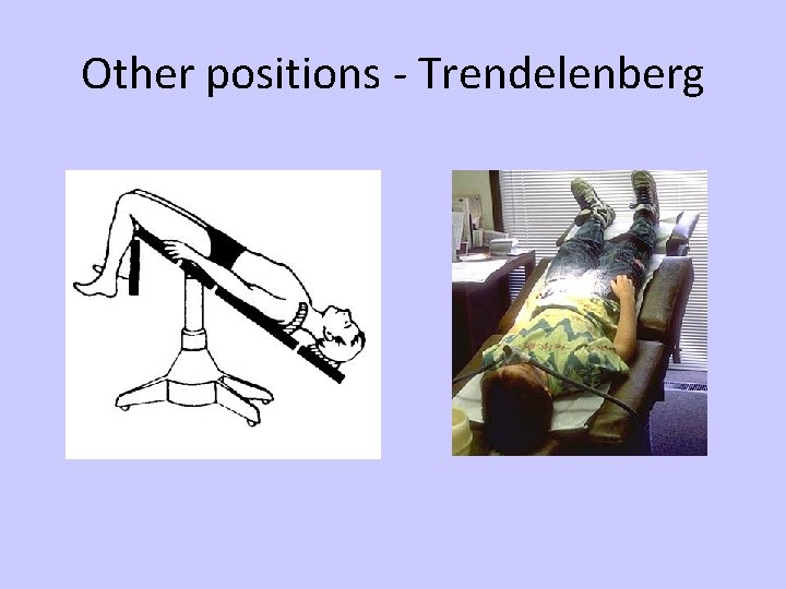 Other positions - Trendelenberg 