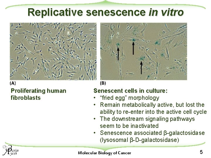 Replicative senescence in vitro Proliferating human fibroblasts Senescent cells in culture: • “fried egg”