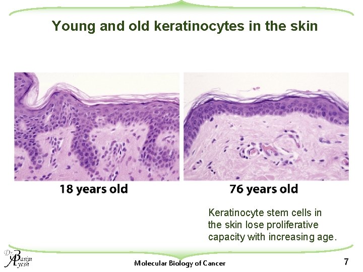 Young and old keratinocytes in the skin Keratinocyte stem cells in the skin lose