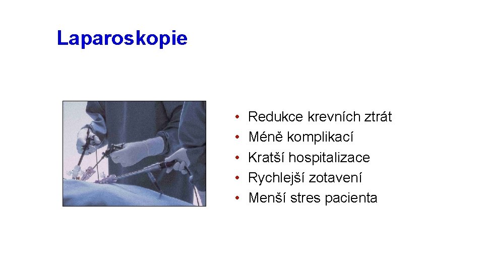 Laparoskopická chirurgie Laparoskopie • • • Redukce krevních ztrát Méně komplikací Kratší hospitalizace Rychlejší