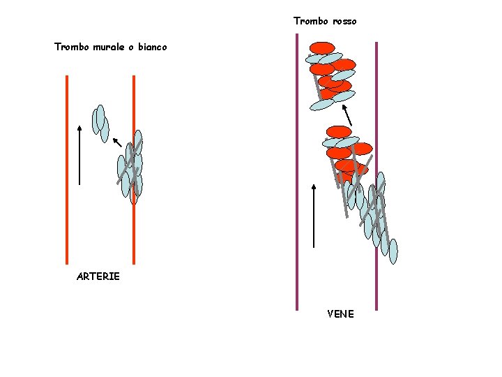 Trombo rosso Trombo murale o bianco ARTERIE VENE 