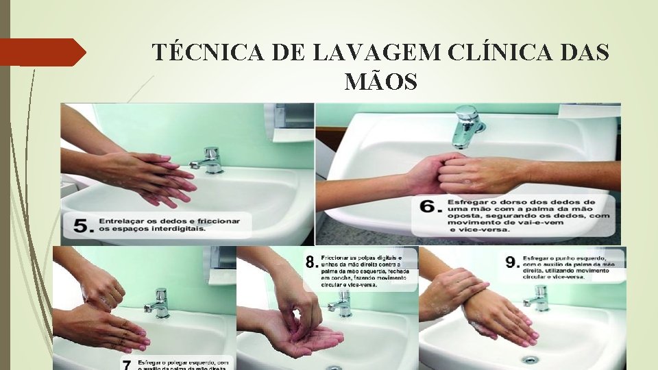 TÉCNICA DE LAVAGEM CLÍNICA DAS MÃOS 