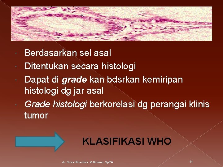 Berdasarkan sel asal Ditentukan secara histologi Dapat di grade kan bdsrkan kemiripan histologi dg
