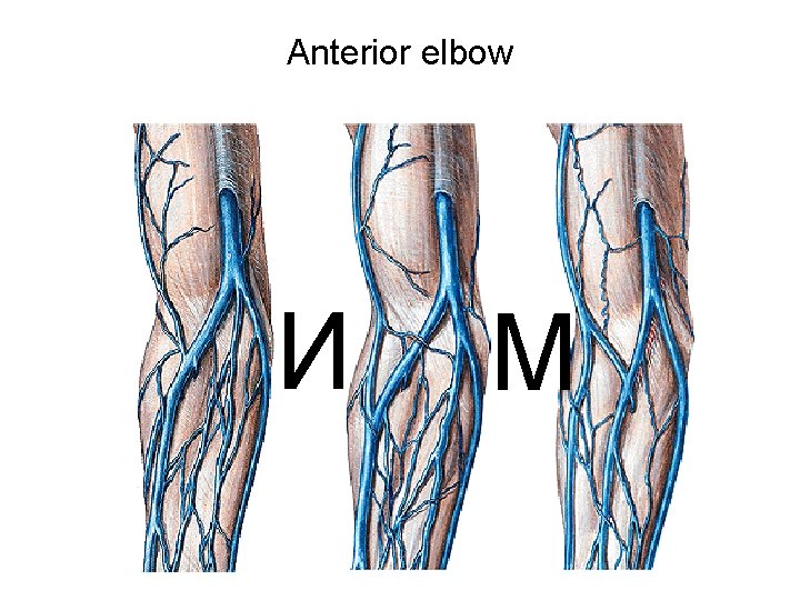 Anterior elbow И M 