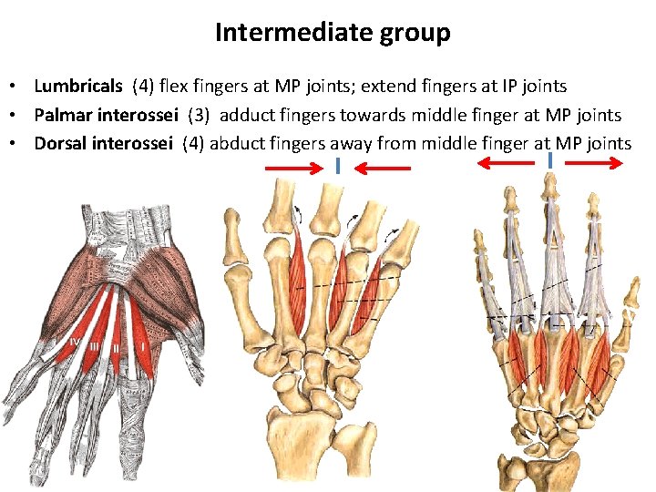 Intermediate group • Lumbricals (4) flex fingers at MP joints; extend fingers at IP
