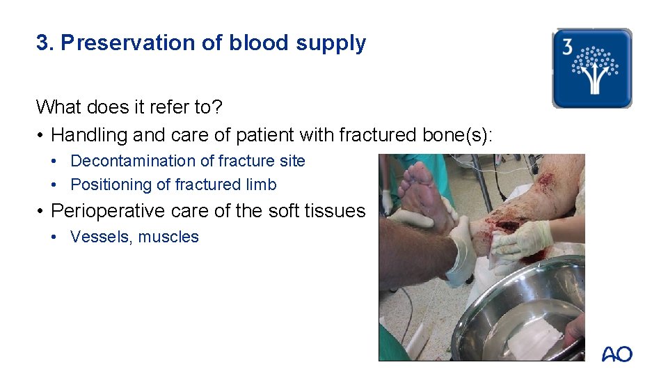 3. Preservation of blood supply What does it refer to? • Handling and care