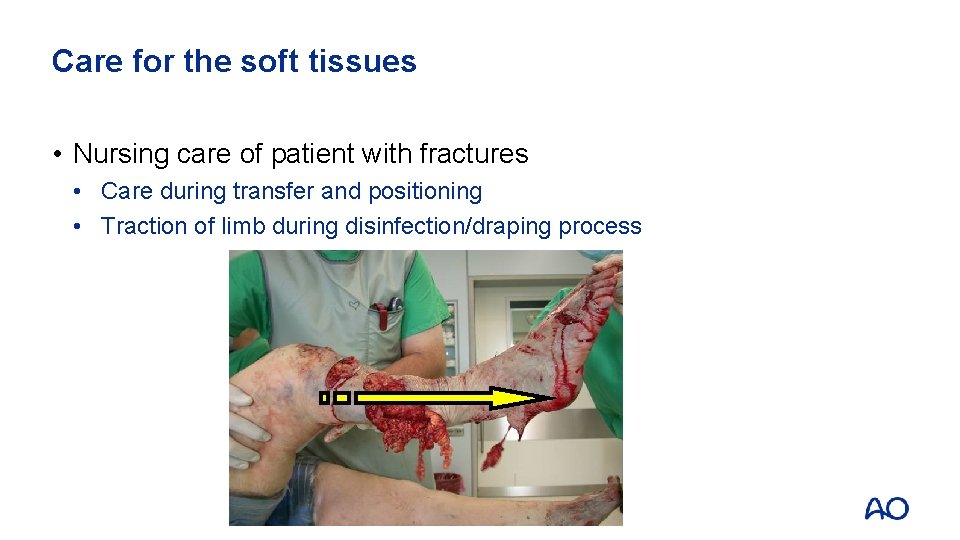 Care for the soft tissues • Nursing care of patient with fractures • Care