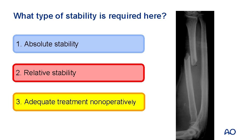 What type of stability is required here? 1. Absolute stability 2. Relative stability 3.