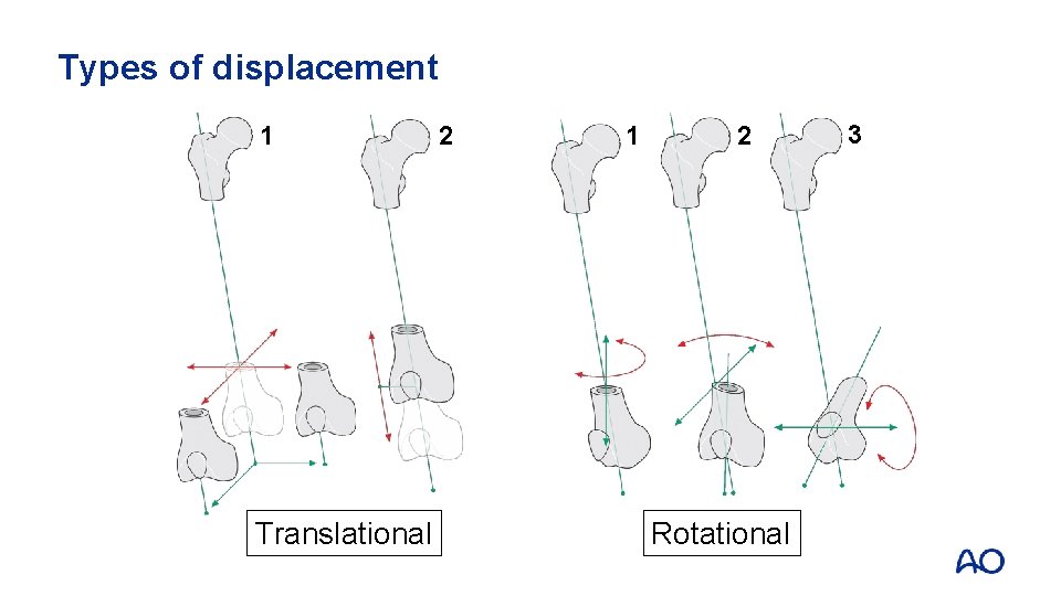 Types of displacement 1 Translational 2 1 2 Rotational 3 