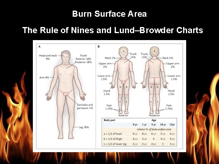 Burn Management Burn Surface Area The Rule of Nines and Lund–Browder Charts Orgill D.